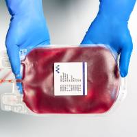 健康人Leukopak采集服务