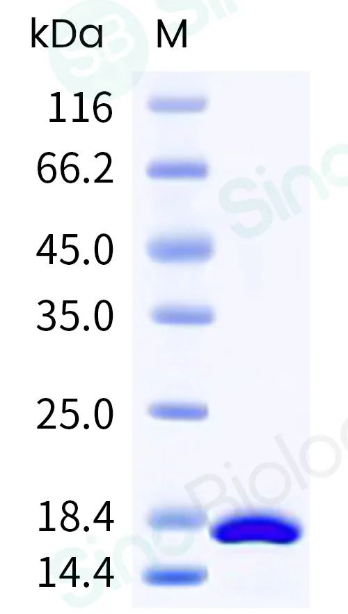 神经系统疾病研究的新兴工具：脑类器官