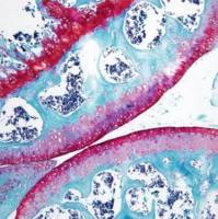 免疫组化番红固绿染色HE染色