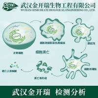 细胞凋亡 -Annexin V/PI双染法| 流式检测细胞凋亡（AV染膜/P I染核）| Annexin V-FITC/PI 双染细胞凋亡检测| 细胞功能学实验/细胞增殖/细胞迁移/细胞侵袭