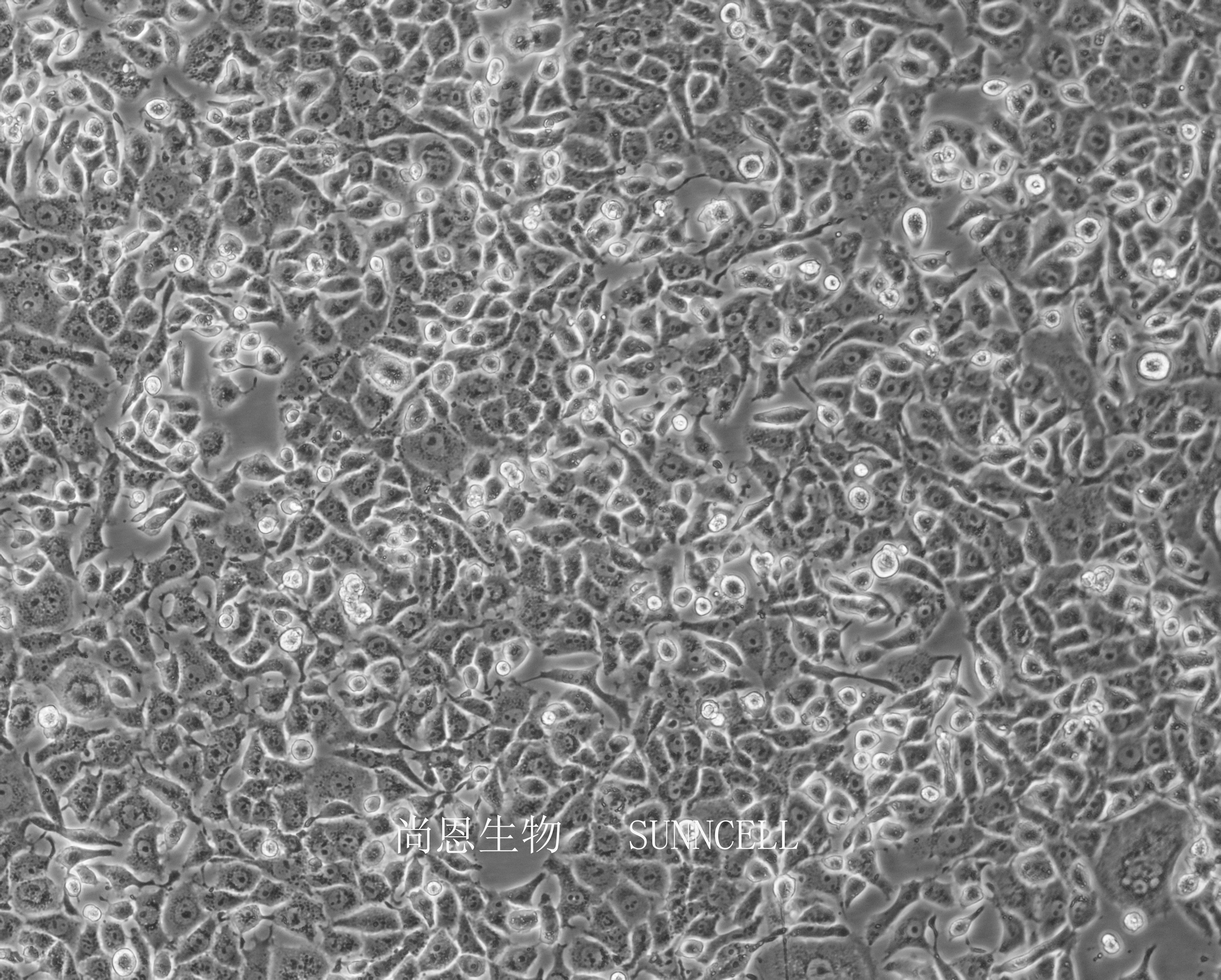 细胞攻略 | Hepa1-6(小鼠肝癌细胞)培养教程