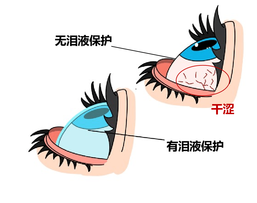 眼睛总是干、痒，甚至会有灼烧感是怎么回事？武汉普瑞眼科医院医生为您讲解