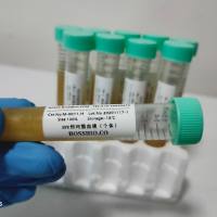 SPF恒河猴血清/单个体/雄或雌