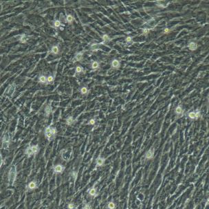 小鼠原代肺微血管周细胞