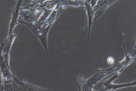 小鼠原代腹腔主动脉平滑肌细胞