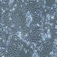 小鼠原代Ⅱ型肺泡上皮细胞