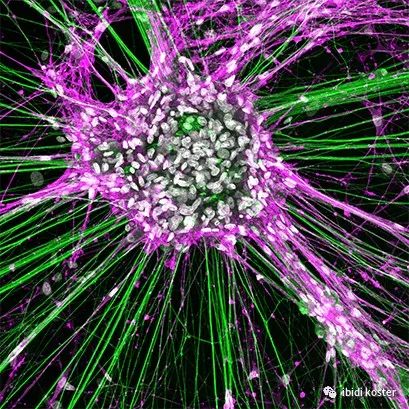 ibidi适用于神经科学的解决方案