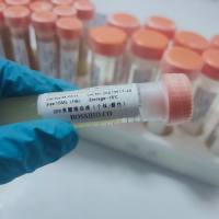 SPF食蟹猴血清/单个体/雄或雌