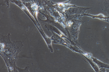 小鼠原代腹腔主动脉平滑肌细胞