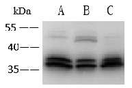 泛癌热门靶点TROP2及研究工具试剂
