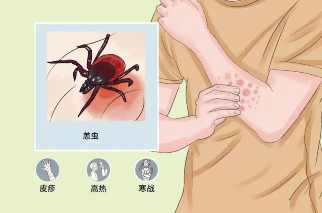 高烧不退还进 ICU，罪魁祸首竟是这种虫子