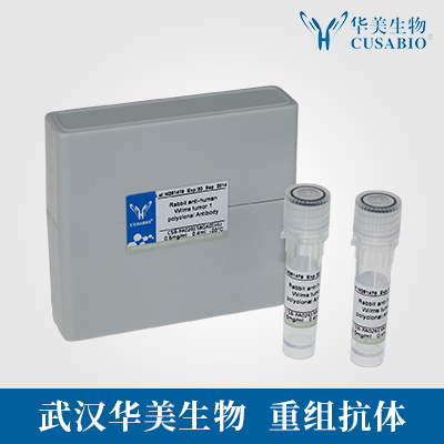 GCGR|GCGR抗体|GCGR Monoclonal Antibody|重组抗体