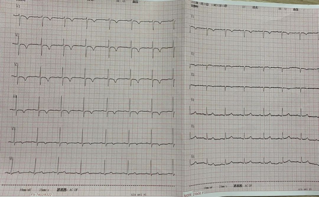 急诊手术，郑大五附院开辟救「心」绿色通道