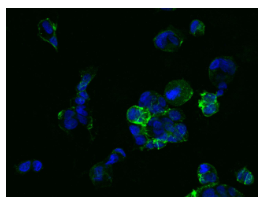 泛癌热门靶点TROP2及研究工具试剂