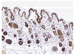 泛癌热门靶点TROP2及研究工具试剂