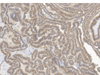 泛癌热门靶点TROP2及研究工具试剂