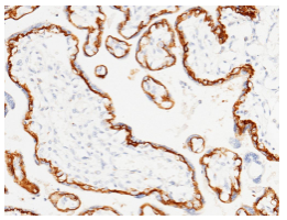 泛癌热门靶点TROP2及研究工具试剂