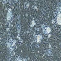 大鼠原代肝外胆管上皮细胞