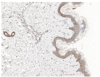 泛癌热门靶点TROP2及研究工具试剂