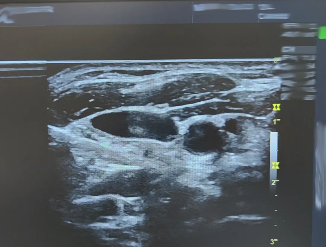 你，为什么睡不着？（请留言！！！）