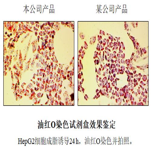 细胞成脂分化与鉴定