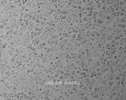 细胞攻略 | Caco-2(人结直肠腺癌细胞)培养教程