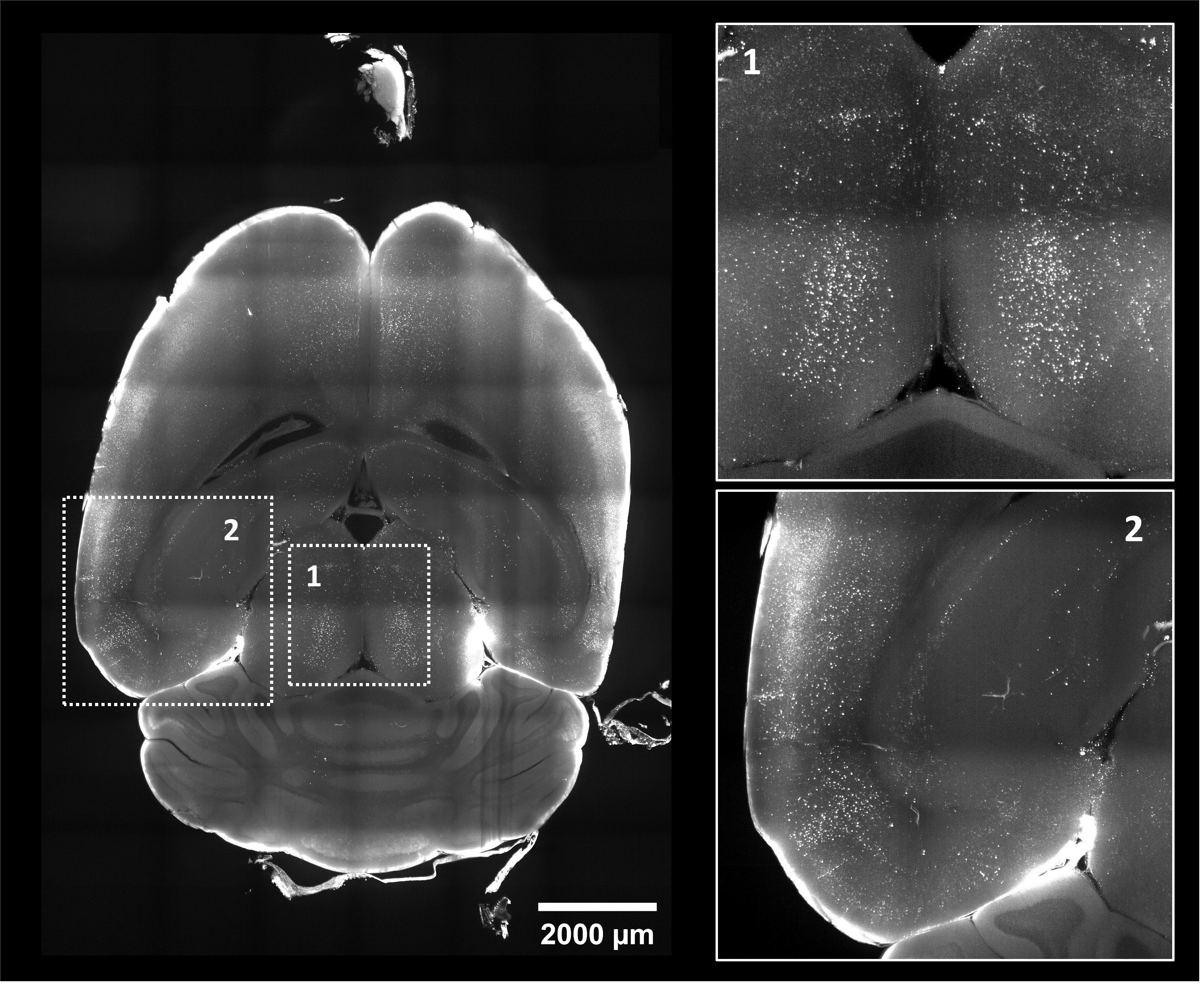 《Nature communications》：基于全脑c-fos组织透明化三维整体成像揭示单个“记忆印迹”在不同大脑区域分布