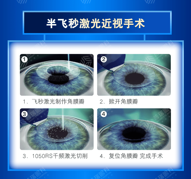 近视手术术后有没有后遗症？术后会不会再次近视？武汉普瑞眼科医院为您科普