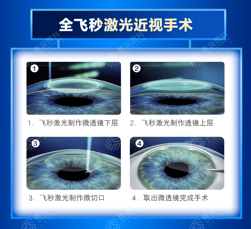 近视手术术后有没有后遗症？术后会不会再次近视？武汉普瑞眼科医院为您科普