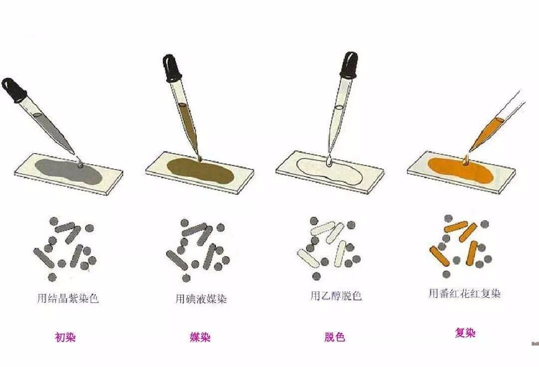 革兰氏染色实验的拓展知识