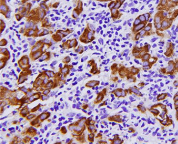 DAB显色试剂盒/DAB Substrate Kit的应用 DAB显色试剂盒/DAB Substrate Kit的应用