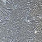 小鼠原代视网膜微血管周细胞