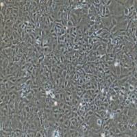 大鼠原代肝窦内皮细胞