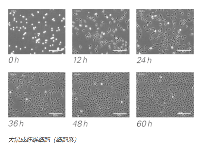 ibidi镜载活细胞培养系统