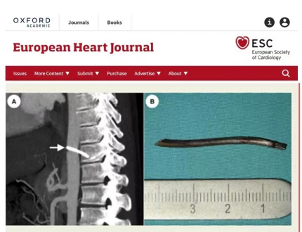 西安交大一附院救治创伤性主动脉损伤的原创成果在《欧洲心脏杂志》发表