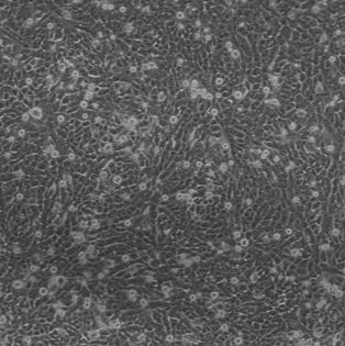143B|人骨肉瘤细胞