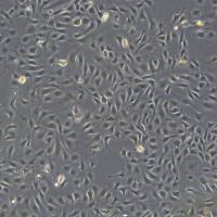 人静脉内皮细胞/HUVEC