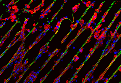 IBIDI易必迪µ-Dish 35 mm, high ESS