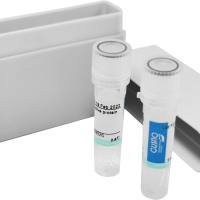 胰岛素样生长因子结合蛋白1（IGFBP-1）