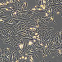 人骨肉瘤细胞Saos-2(Luc1)现货