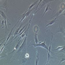 大鼠原代牙周膜干细胞