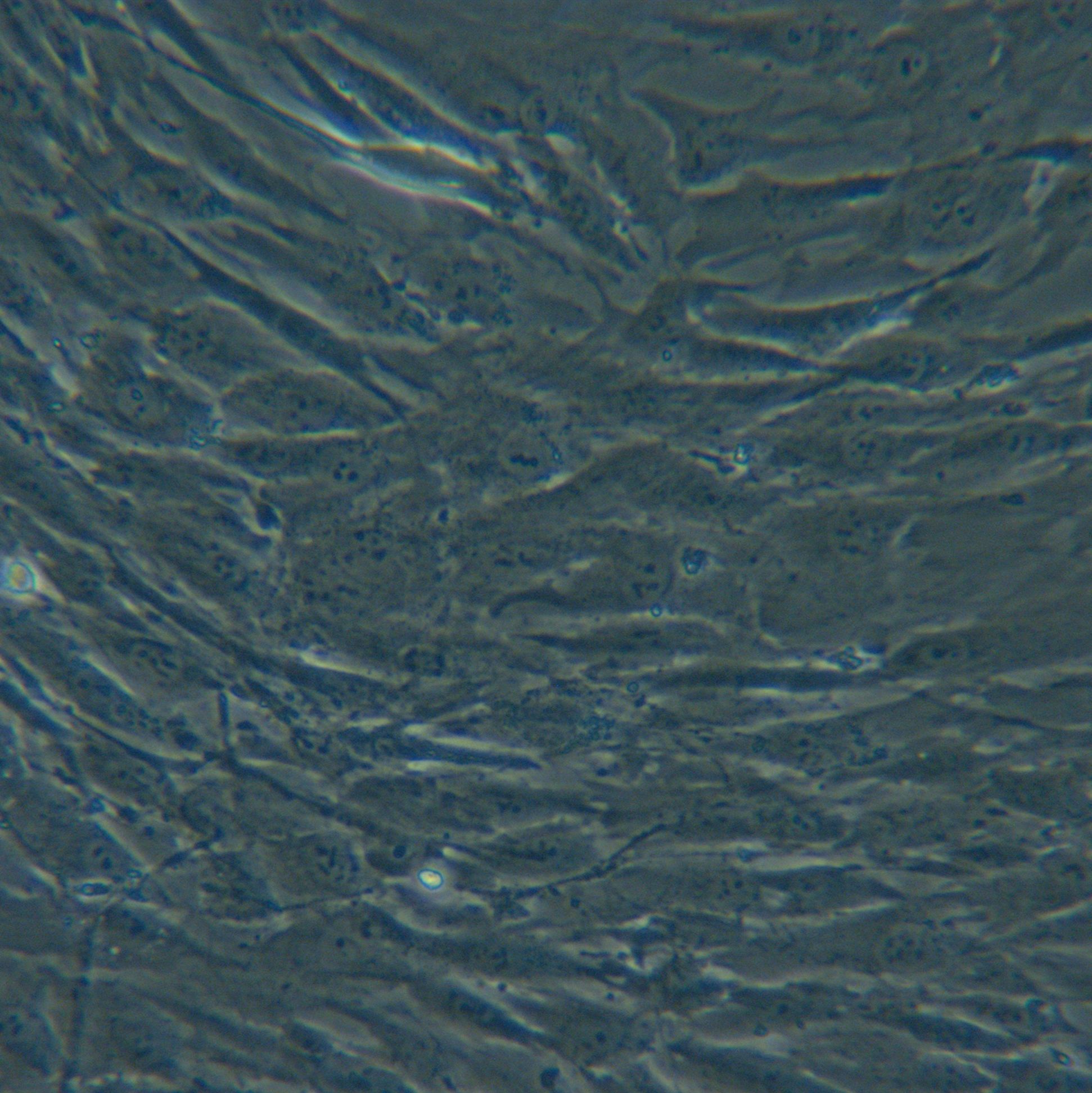 HMSC-bm永生化人骨髓间充质干细胞