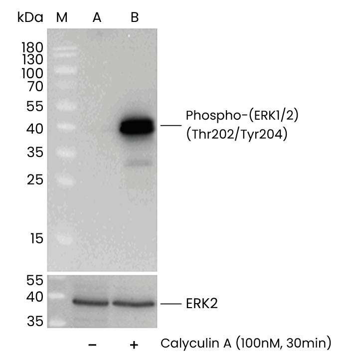 信号转导的风暴中心：ERK1/2