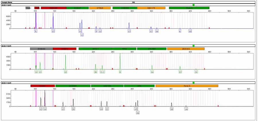 厦门逸漠细胞STR鉴定技术服务