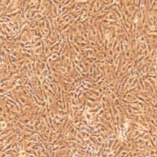 大鼠原代脉络膜微血管内皮细胞