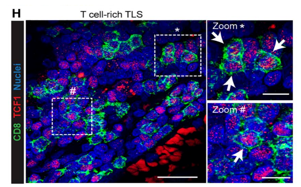 文献分享丨Cancer Cell刊登新型AAV基因疗法，用于攻克脑肿瘤！