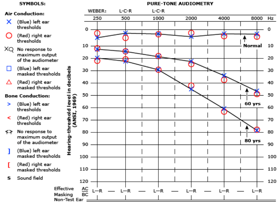 仁树医院广州院区「不容忽视的老年性聋」
