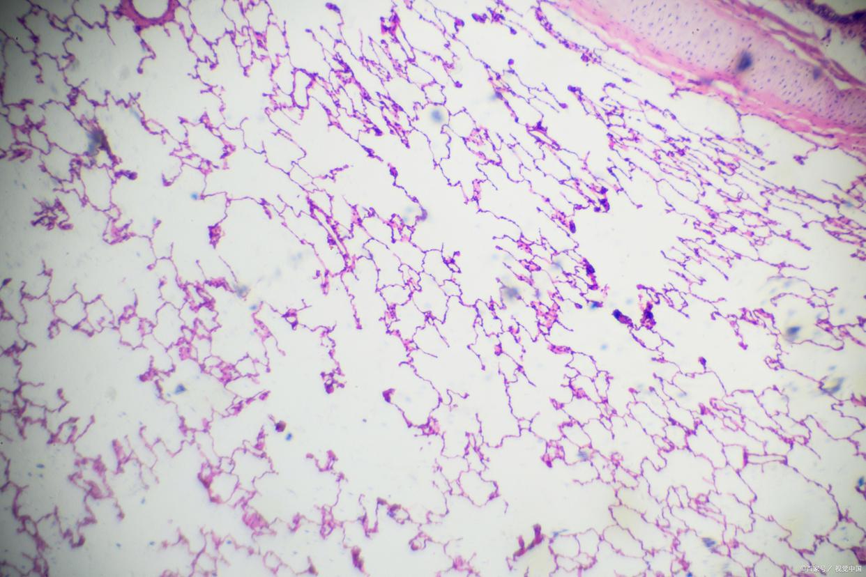 （革兰氏染色实验）革兰氏染色技巧