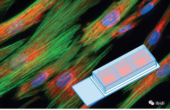 ibidi一体化免疫荧光实验|细胞培养，固定，染色和成像观察--都是在一个小室中完成