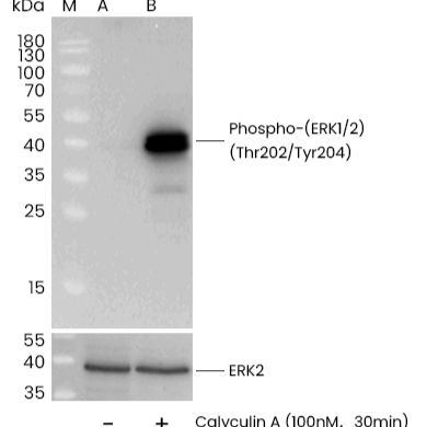 Phospho-ERK1/2 (Thr202, Tyr204) Antibody, Rabbit MAb